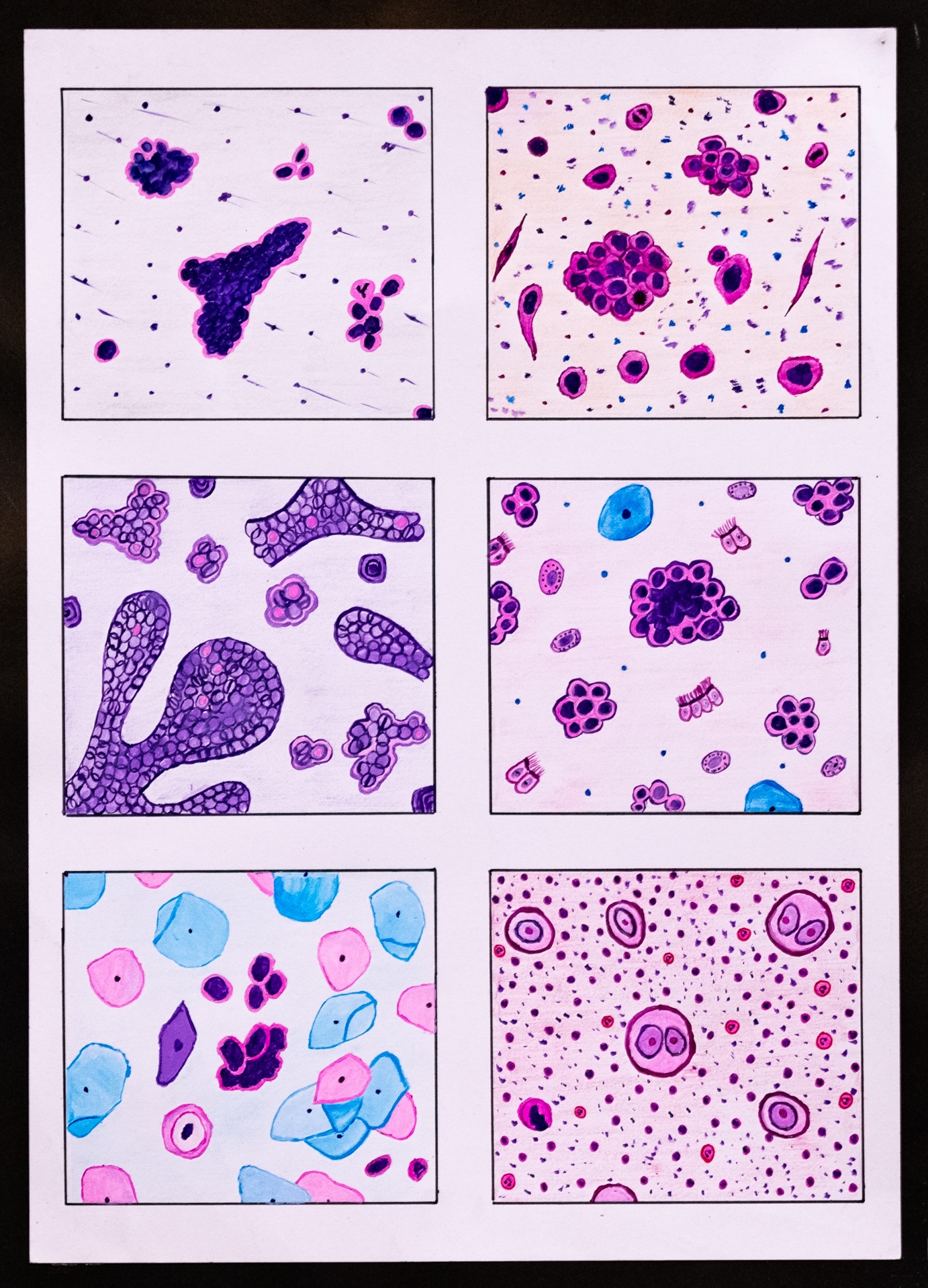 ‘Cytology: Tracing the Footprints of Disease through the lens’ by Dr Rathnayake Mohottalalage Jinali Bhagya Rathnayake