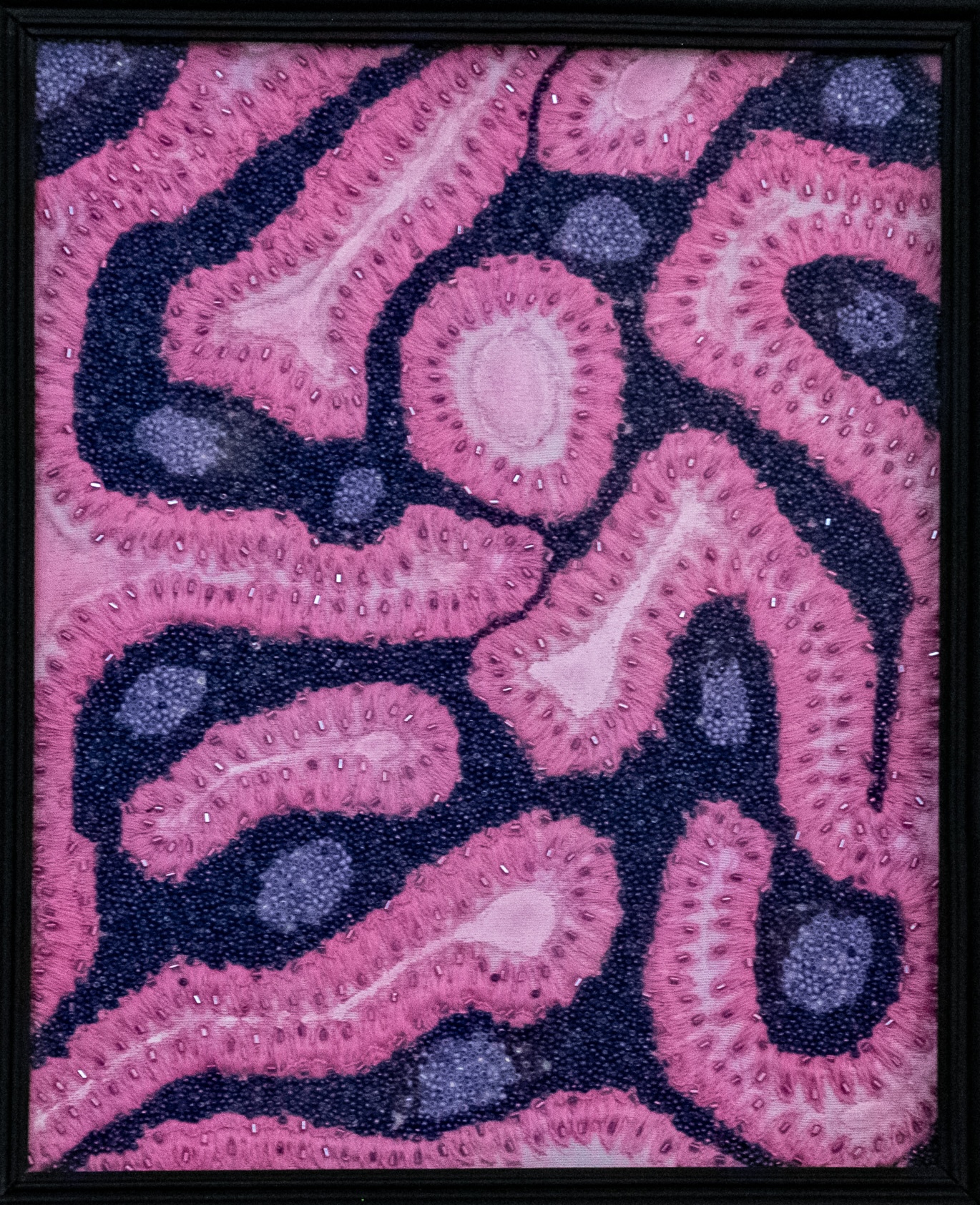 First Place: ‘Artistic inspiration of Warthin tumour’ by Dr Salpadoru Patabendige Ruwani Sandamalika Kumari