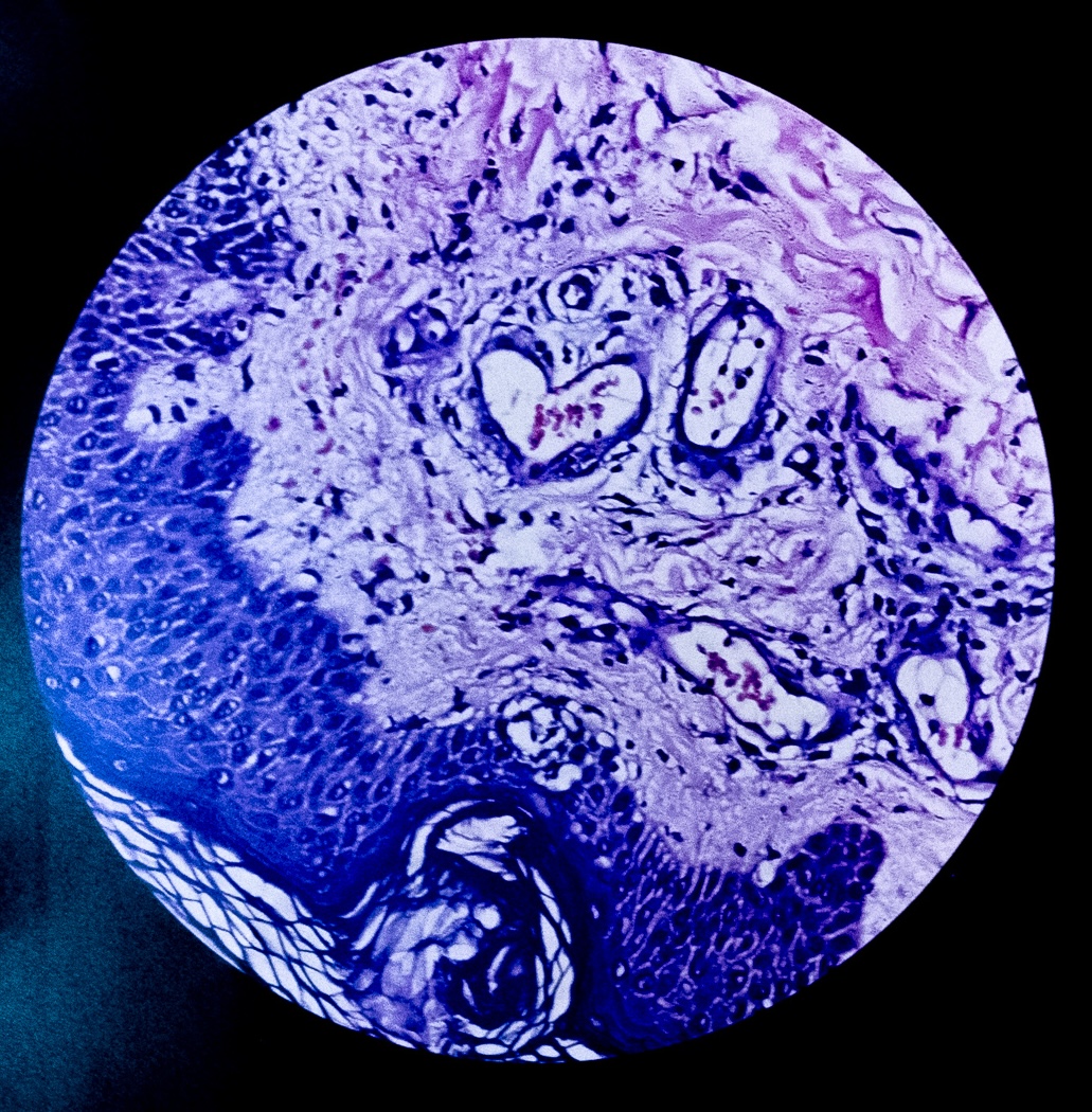 ‘Love Beneath the Lens’ by Dr Rathnayake Mohottalalage Jinali Bhagya Rathnayake