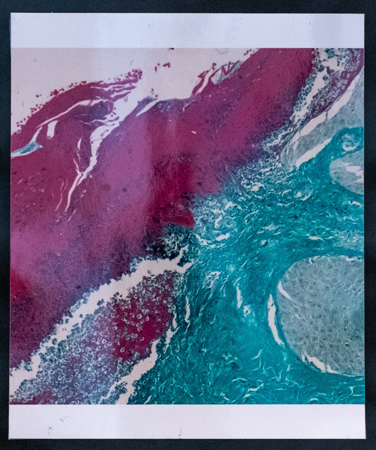 ‘A volcano erupting with lava splashing from a green valley’ by Dr Jayathunga Arrachchige Kaumadi Udeshika