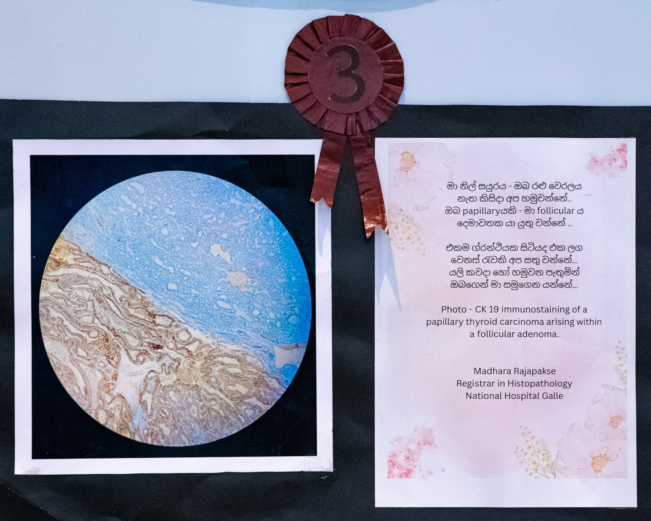 Third Place: ‘මා නිල් සයුරය - ඔබ රළු වෙරලය නැත කිසිදා අප හමුවන්නේ..’ by Dr Madhara Mandhodaree Rajapakse