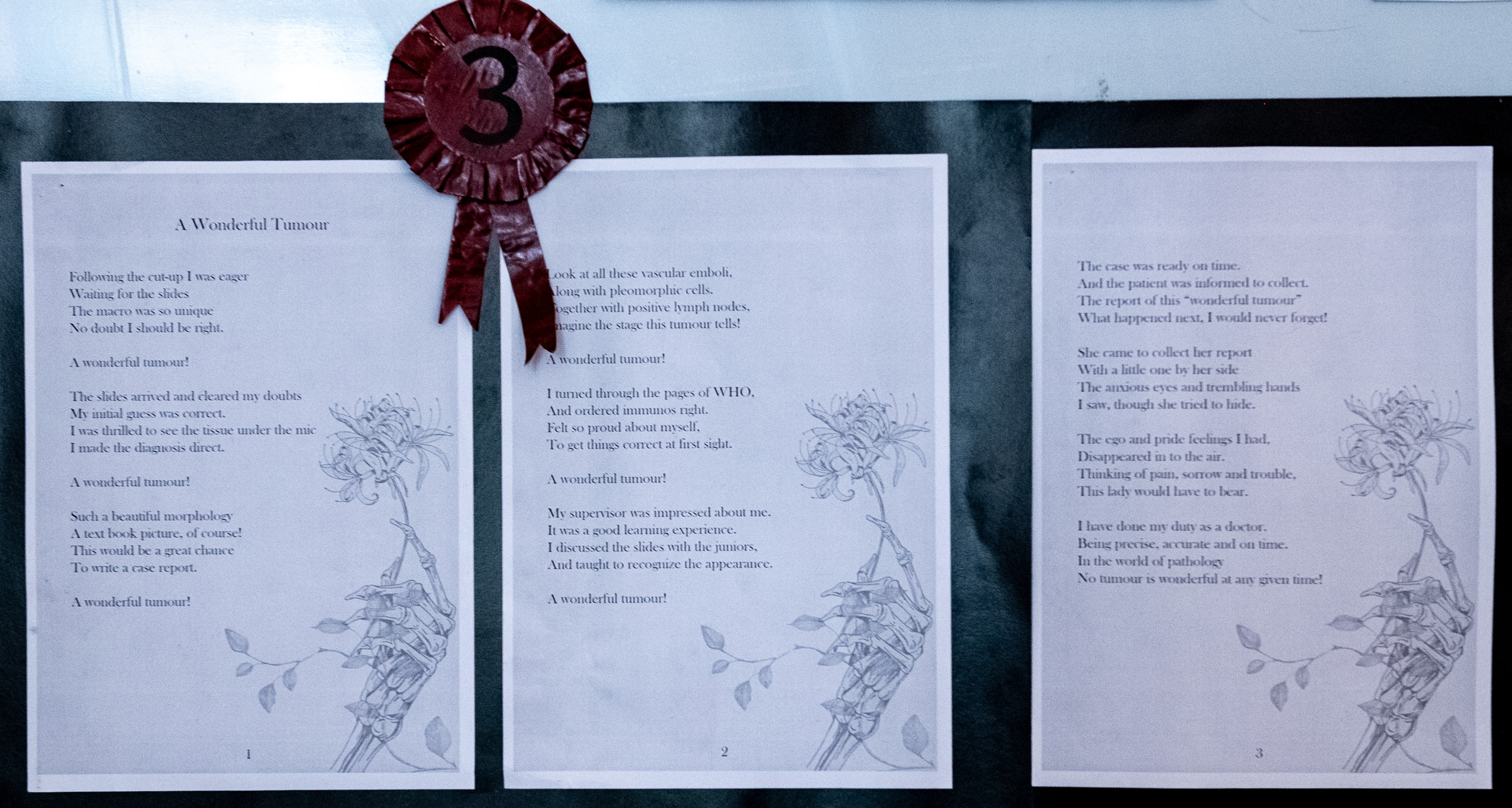 Third Place: ‘A wonderful tumour’ by Dr L.D. Wickramasinghe