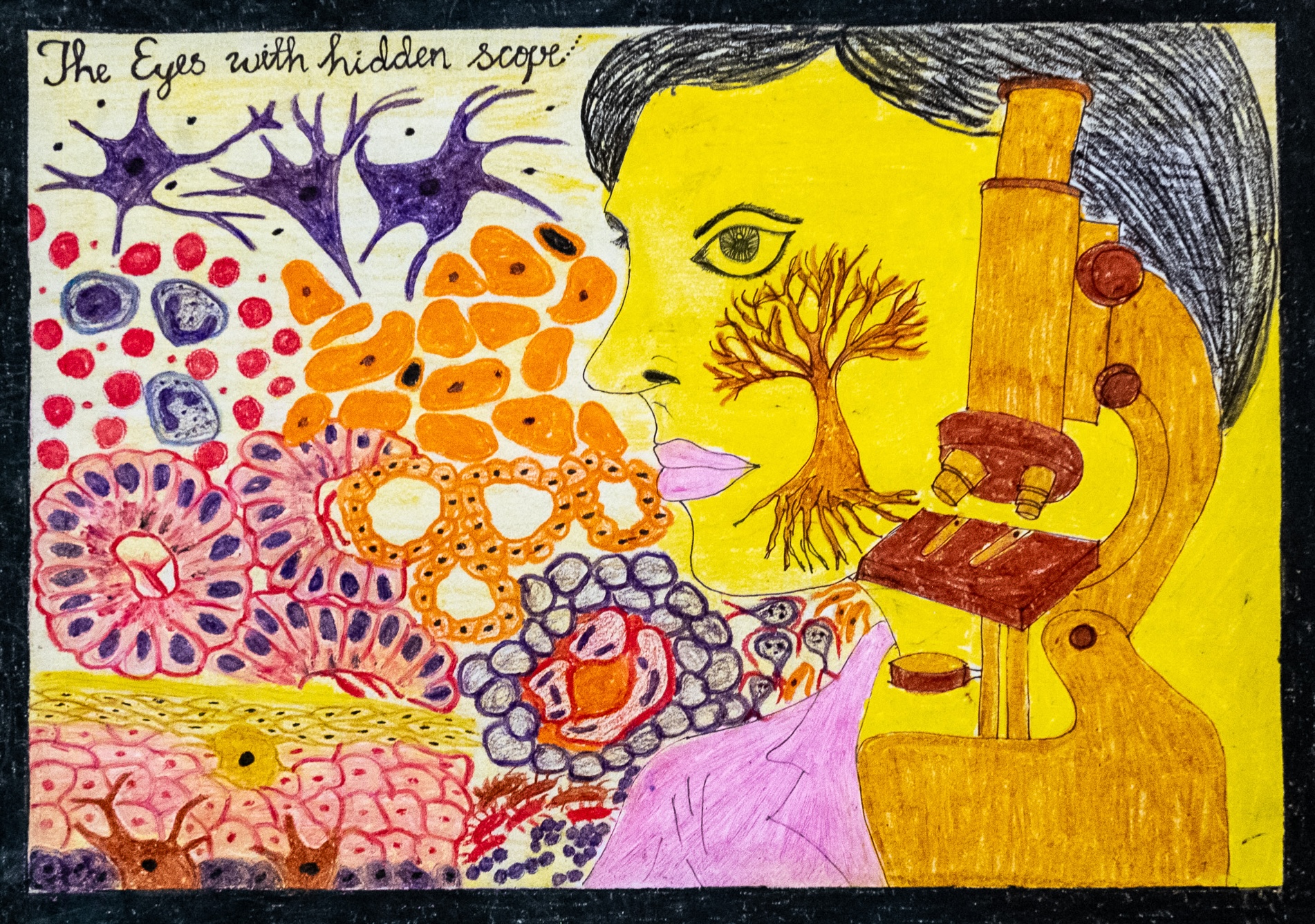 ‘The Eyes with hidden scope’ by Dr Lohithalinkam Logica